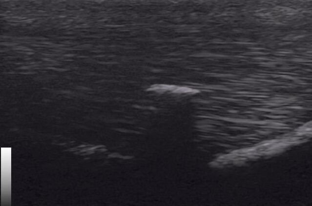 Equine ultrasound image